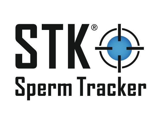 STK Sperm Tracker